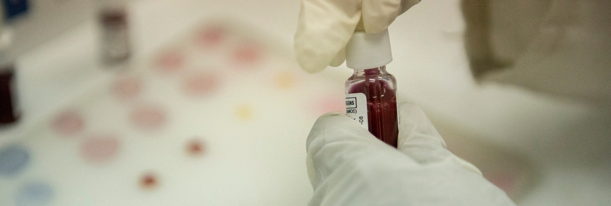 HIV Testing After a First Positive Rapid Diagnostic Test A Role for